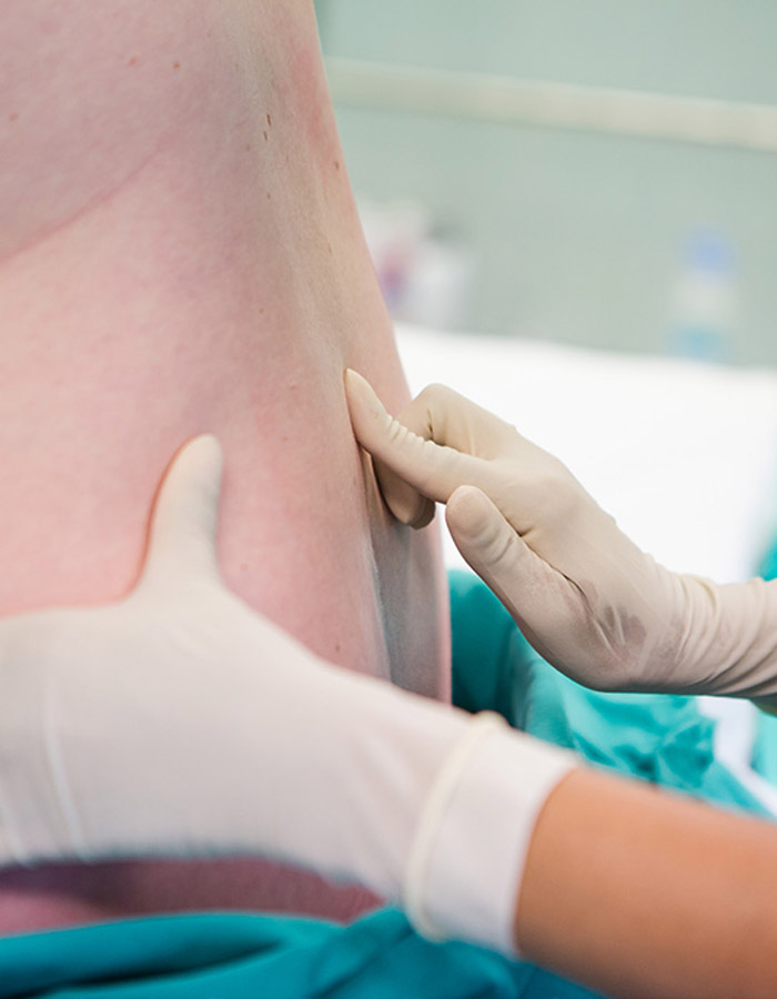 Spine Surgery Department Spine Surgery Department