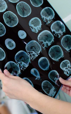 Neurology Department Neurology Department