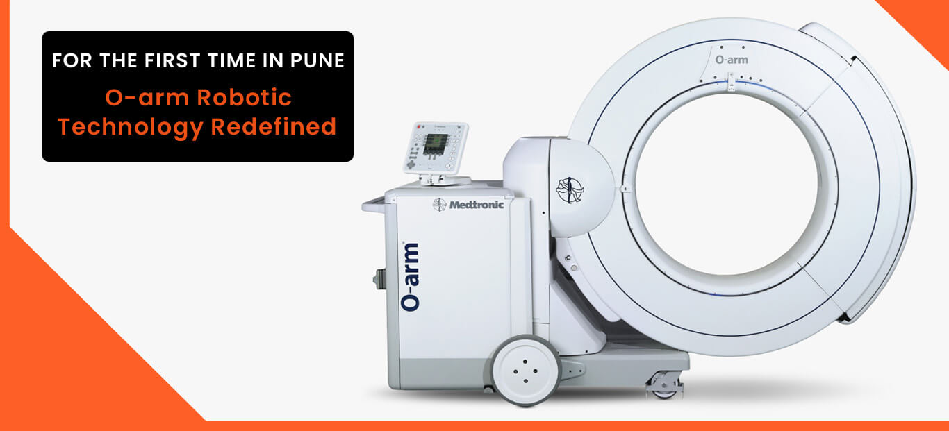 O - Arm Robotic Technology Redefined