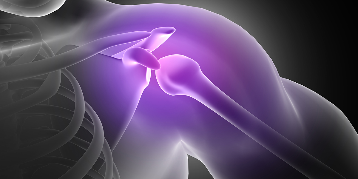 shoulder fracture